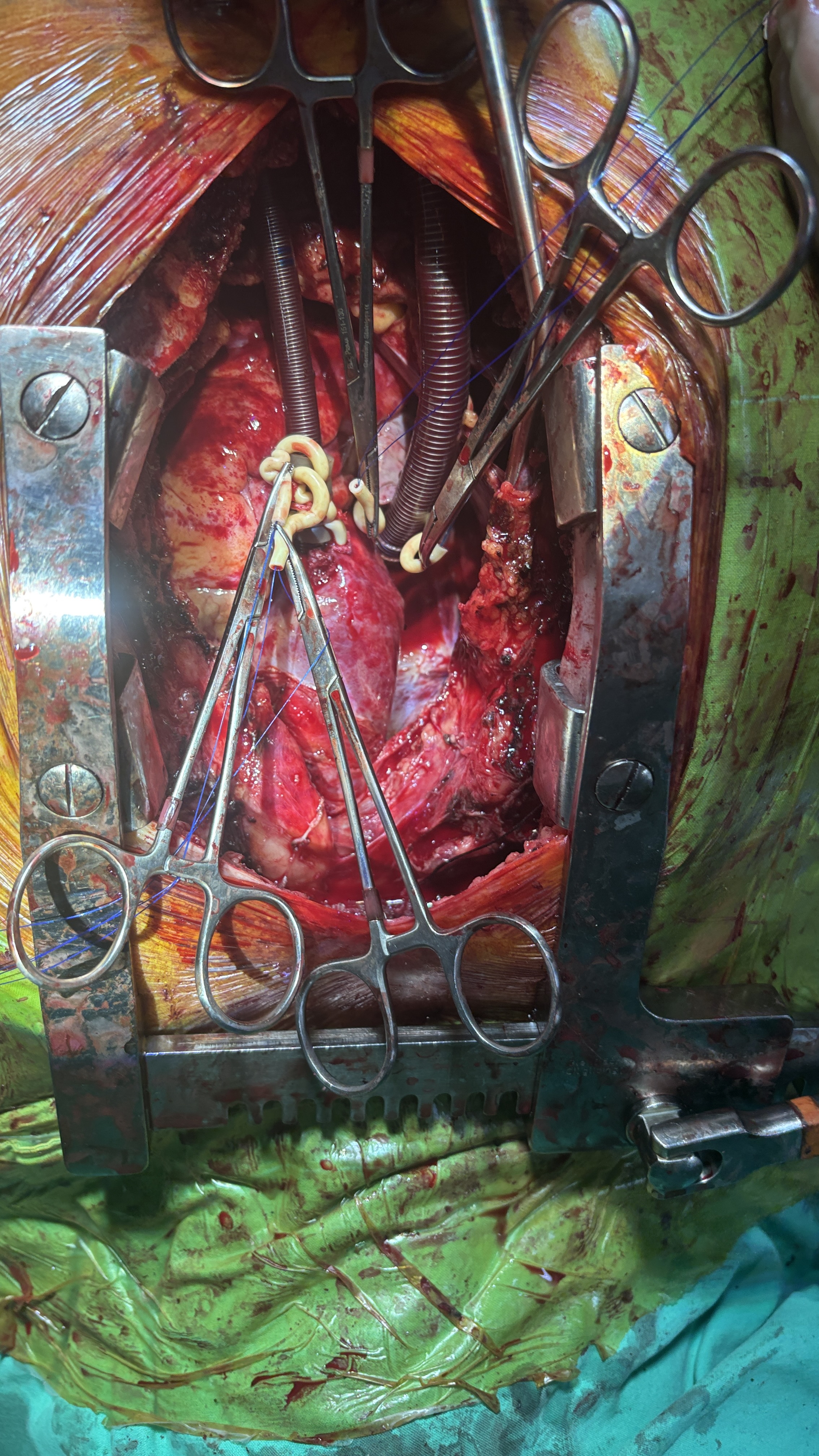 該去拜拜了（內有血腥照）